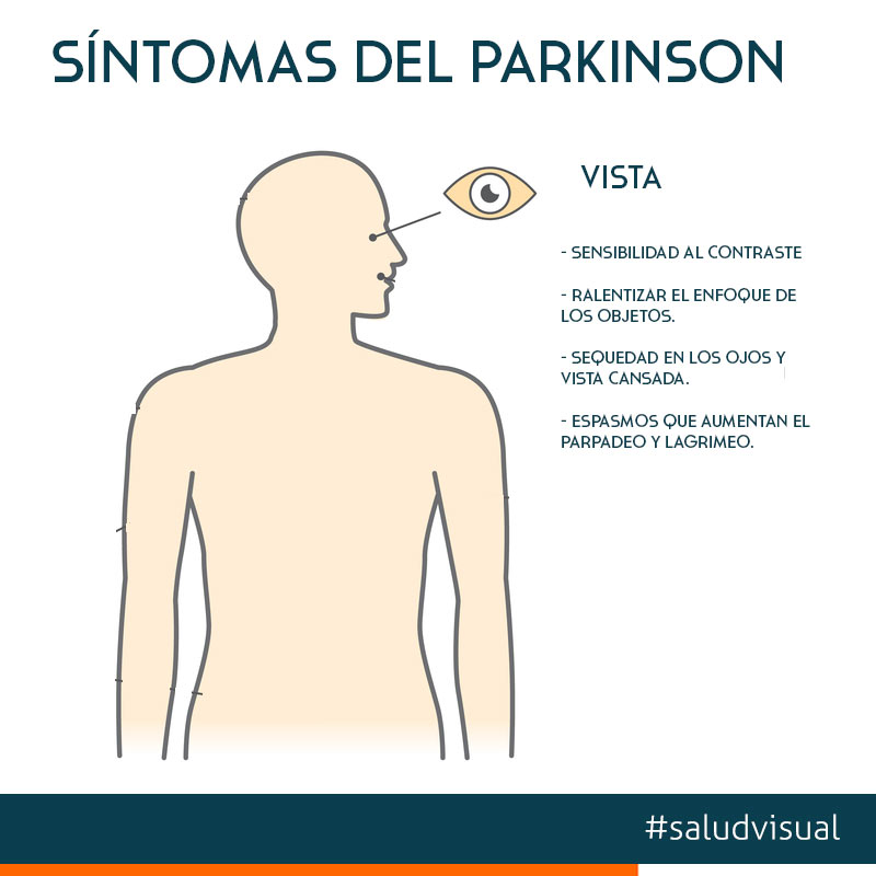 sintomas del parkinson en la vista