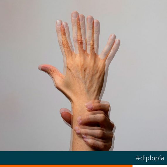 ¿Qué es la Diplopia o Visión Doble? Sintomas y Tratamientos